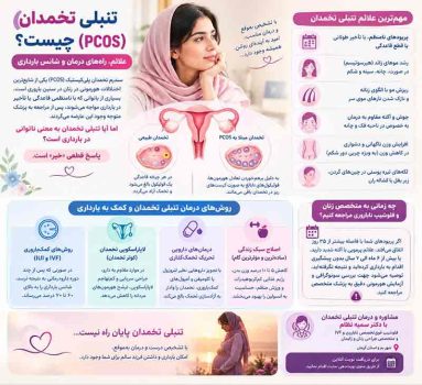 درمان تنبلی تخمدان و بارداری دکتر سمیه نظام